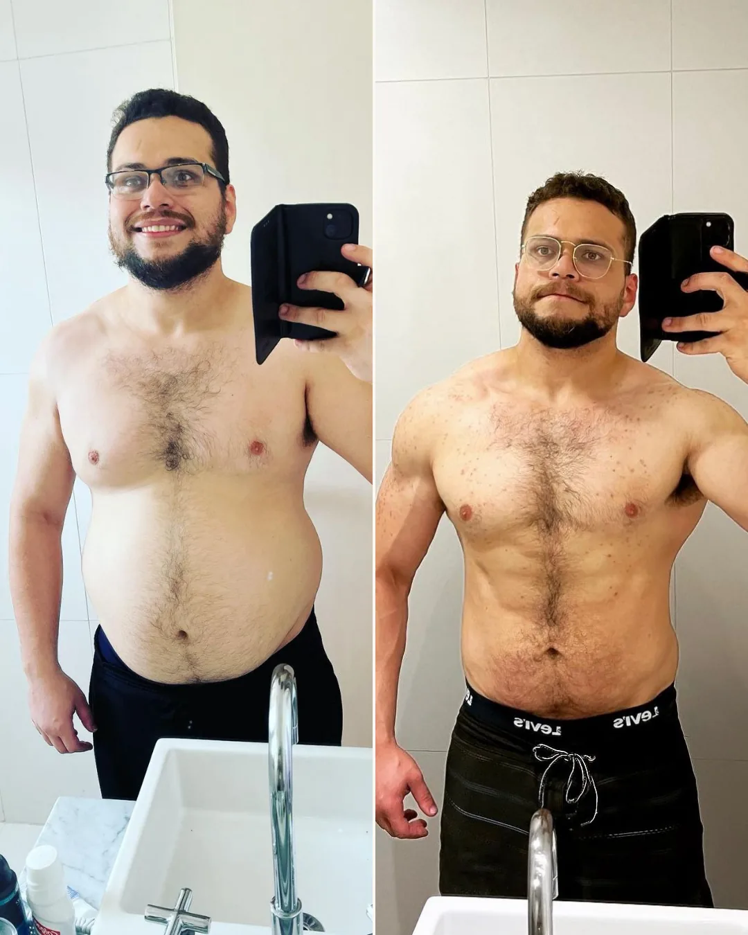 Antes e depois do Dr. Haroldo